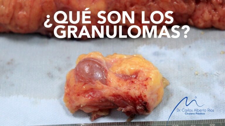 Cuidados Postoperatorios Esenciales en Cirug&iacute;a de Pulm&oacute;n para Mascotas