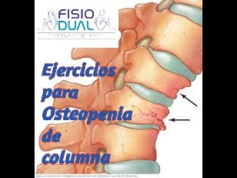 Beneficios de los Ejercicios de Estiramiento con Fisioterapeutas