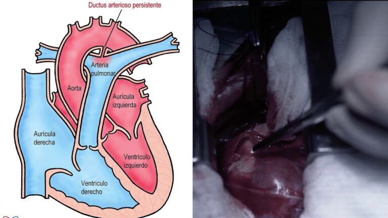 Avances en Cirug&iacute;a de Coraz&oacute;n para Perros y Gatos