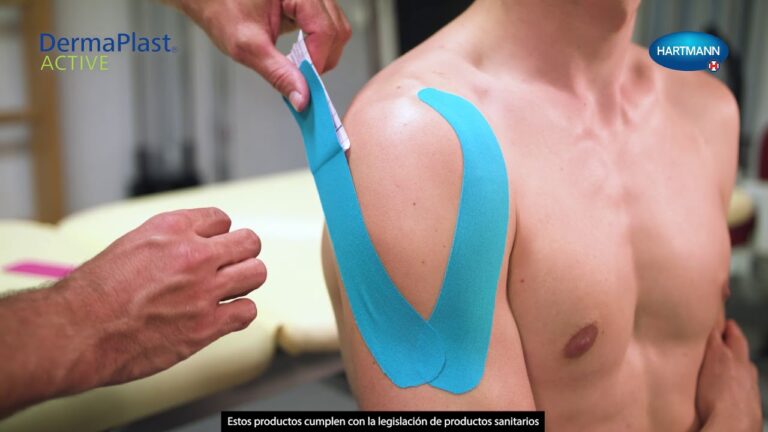 Aplicaciones del Kinesiotaping para el Soporte Muscular