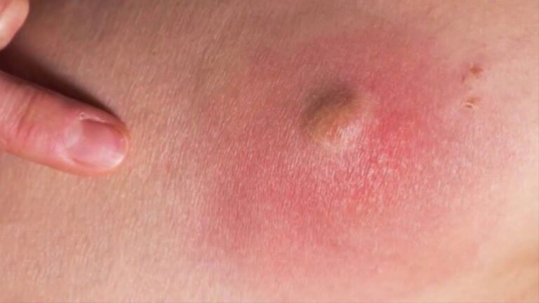 Soluciones Quir&uacute;rgicas para Problemas Cut&aacute;neos en Mascotas