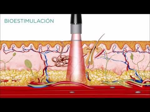 Acupuntura en Veterinaria: Una Alternativa Terap&eacute;utica Efectiva