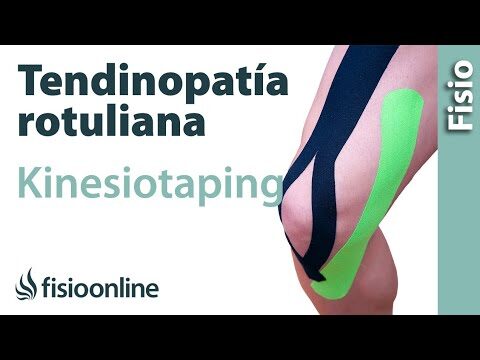 Efectividad del Kinesiotaping en el Tratamiento de Lesiones